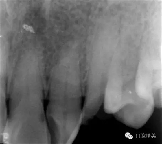 640.webp (1).jpg 640.webp (1).jpg