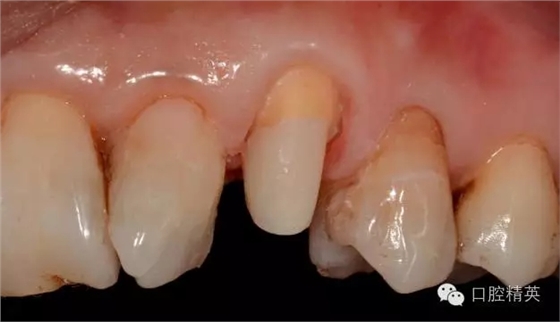 640.webp (3).jpg 640.webp (3).jpg