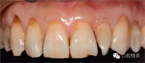 640.webp (9).jpg 640.webp (9).jpg