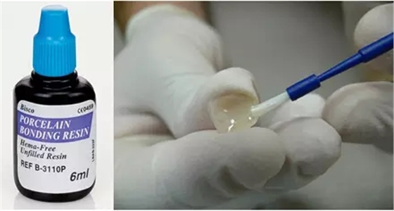 貼面粘接操作流程及要點(diǎn) 貼面粘接操作流程及要點(diǎn)