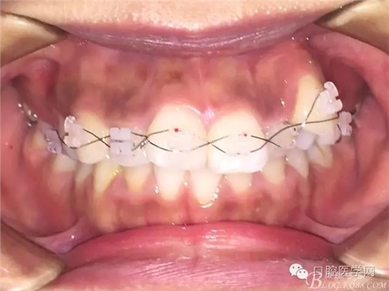 640.webp.jpg 640.webp.jpg