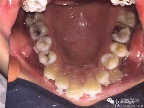 640.webp (2).jpg 640.webp (2).jpg