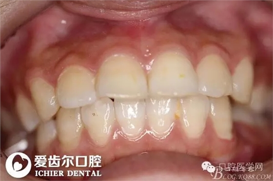 640.webp.jpg 640.webp.jpg