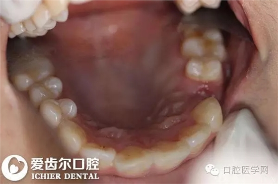 640.webp (3).jpg 640.webp (3).jpg