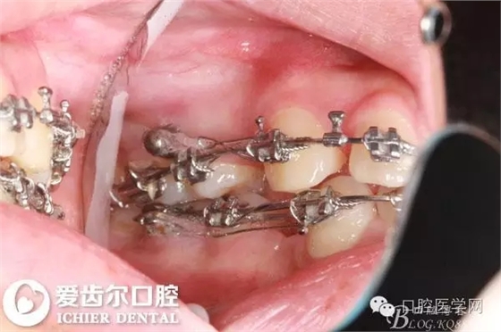 640.webp (7).jpg 640.webp (7).jpg