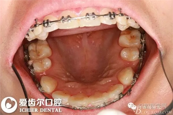 640.webp (11).jpg 640.webp (11).jpg