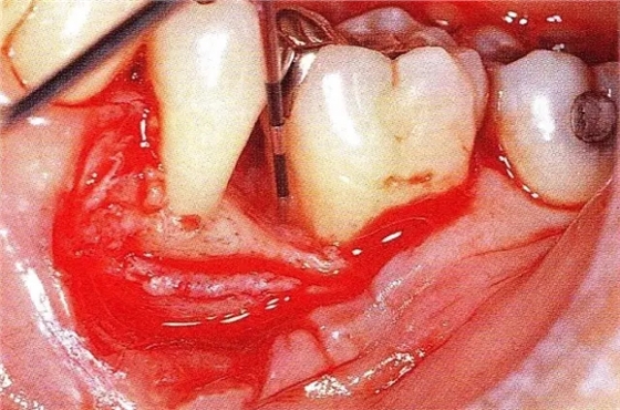 640.webp (3).jpg 640.webp (3).jpg