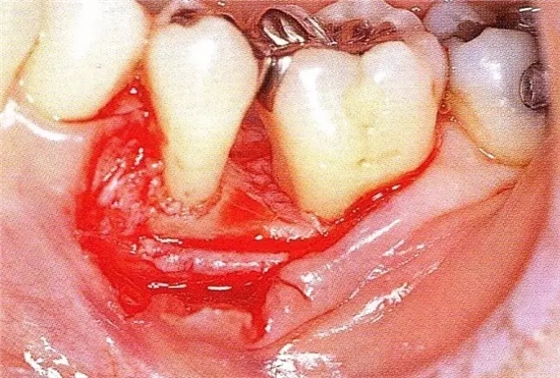 640.webp (4).jpg 640.webp (4).jpg