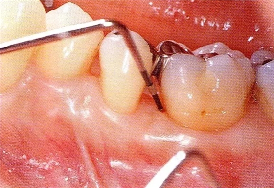 640.webp (5).jpg 640.webp (5).jpg