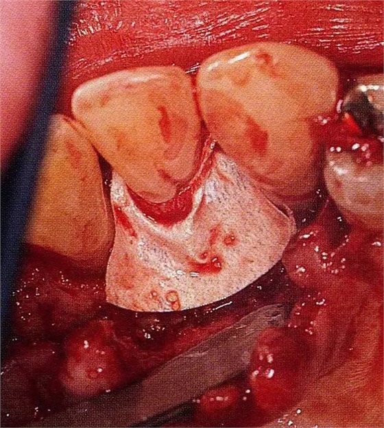 640 (3).jpg 640 (3).jpg