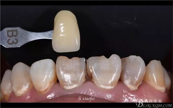 640.webp (1).jpg 640.webp (1).jpg