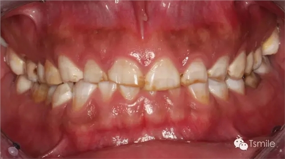 640.webp.jpg 640.webp.jpg