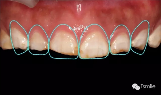 640.webp (2).jpg 640.webp (2).jpg