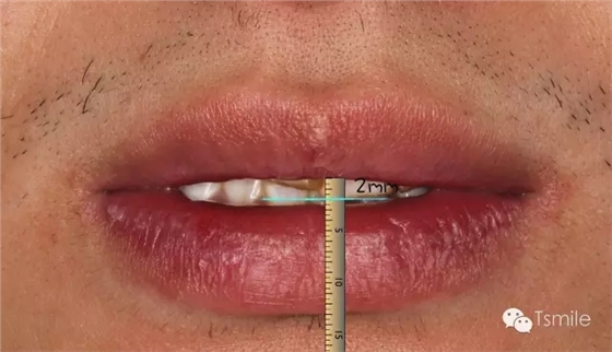 640.webp (3).jpg 640.webp (3).jpg