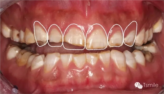 640.webp (5).jpg 640.webp (5).jpg