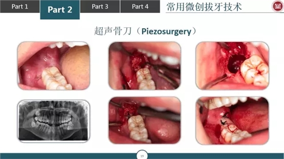 640.webp (2).jpg 640.webp (2).jpg