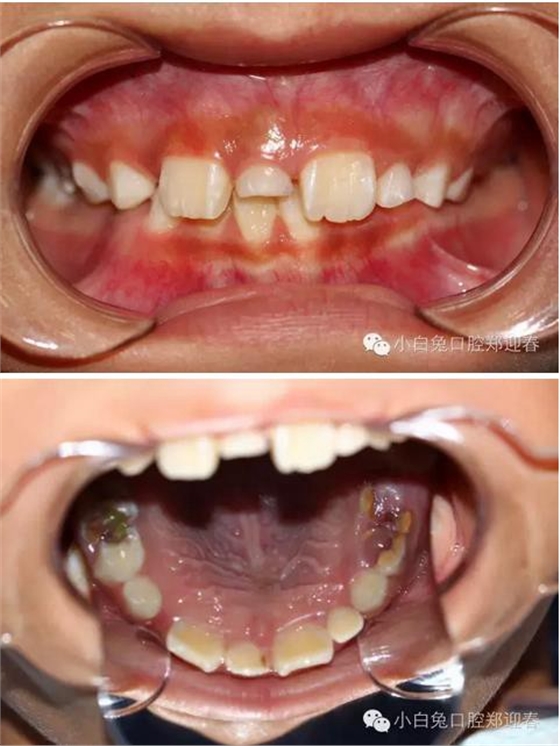 360截圖20170120144343560.jpg 360截圖20170120144343560.jpg