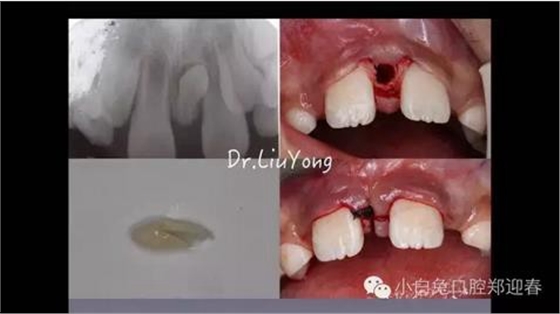 360截圖20170120144531871.jpg 360截圖20170120144531871.jpg