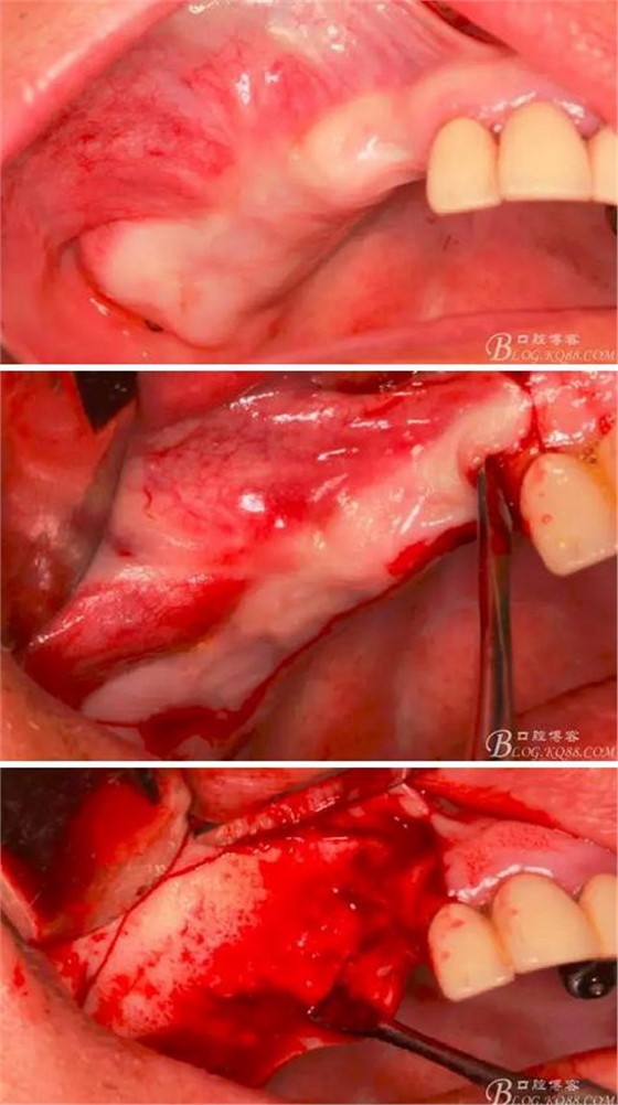 360截圖20170120155604863.jpg 360截圖20170120155604863.jpg