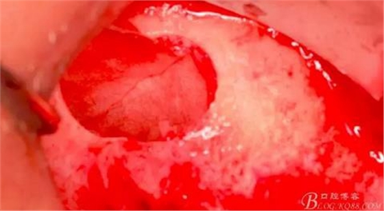 360截圖20170120155801829.jpg 360截圖20170120155801829.jpg