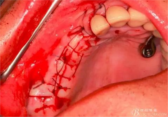 360截圖20170120155839315.jpg 360截圖20170120155839315.jpg