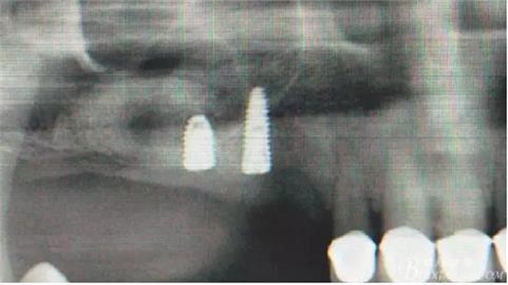 360截圖20170120155850060.jpg 360截圖20170120155850060.jpg