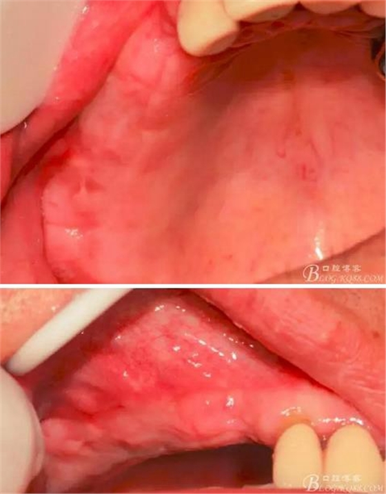 360截圖20170120155909344.jpg 360截圖20170120155909344.jpg