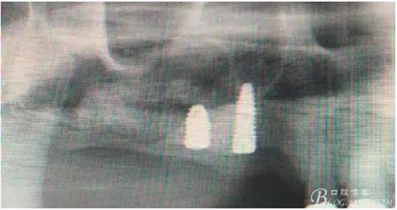 360截圖20170120155918215.jpg 360截圖20170120155918215.jpg
