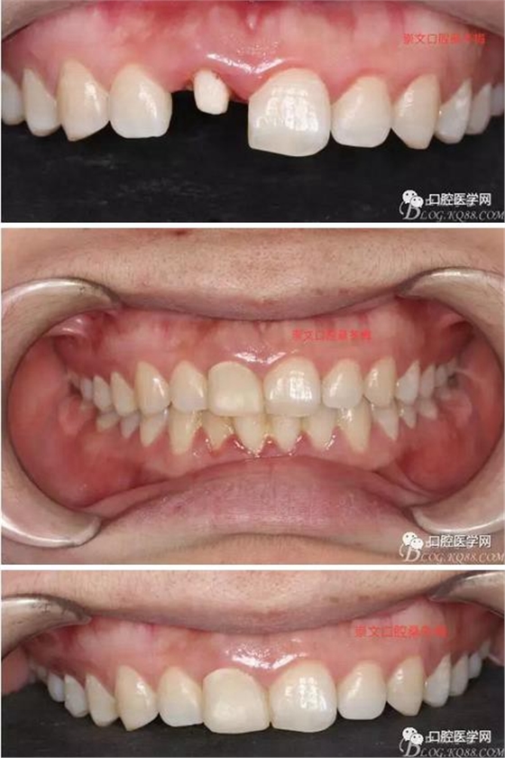 360截圖20170120163759213.jpg 360截圖20170120163759213.jpg