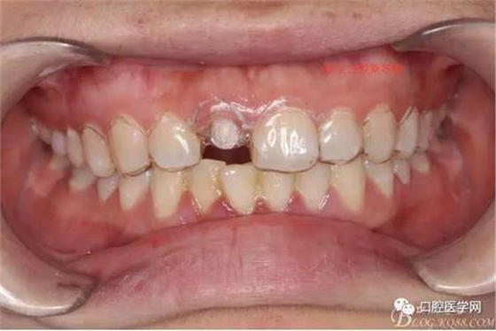 360截圖20170120163816908.jpg 360截圖20170120163816908.jpg