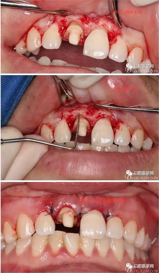 360截圖20170120163839662.jpg 360截圖20170120163839662.jpg