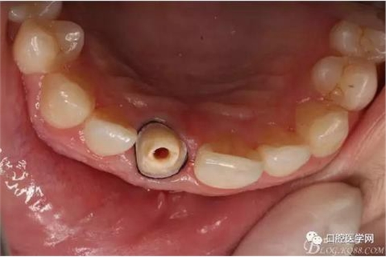 360截圖20170120164007133.jpg 360截圖20170120164007133.jpg