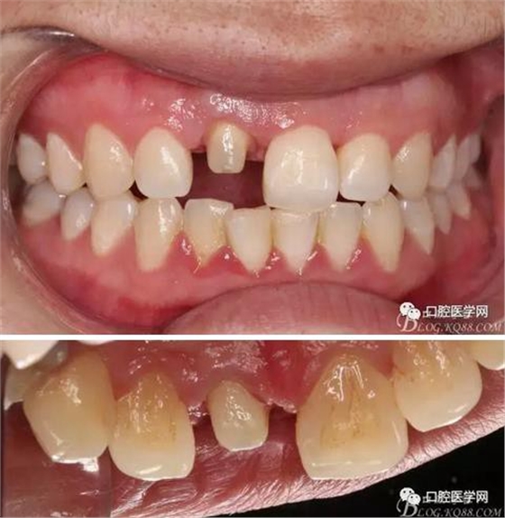 360截圖20170120164033550.jpg 360截圖20170120164033550.jpg