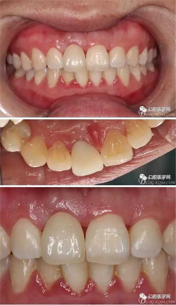 360截圖20170120164051302.jpg 360截圖20170120164051302.jpg