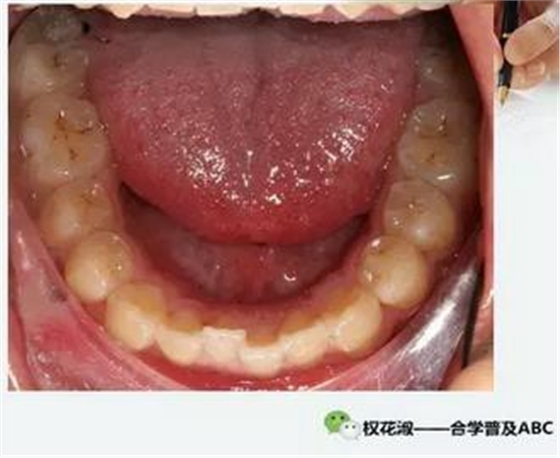 360截圖20170121090325322.jpg 360截圖20170121090325322.jpg