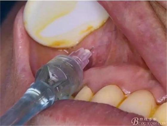 360截圖20170121151654230.jpg 360截圖20170121151654230.jpg