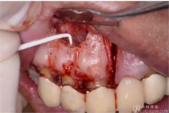 360截圖20170121154228478.jpg 360截圖20170121154228478.jpg