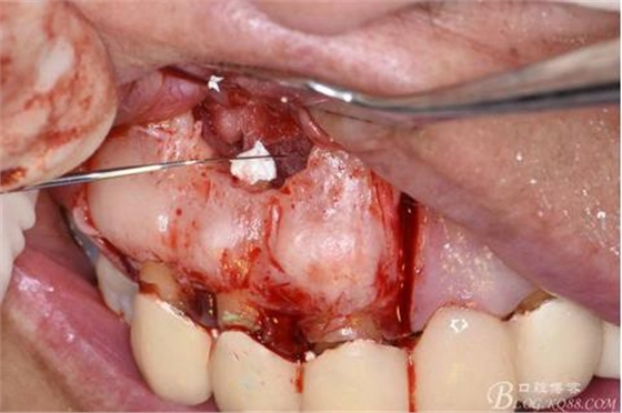 360截圖20170121152123769.jpg 360截圖20170121152123769.jpg