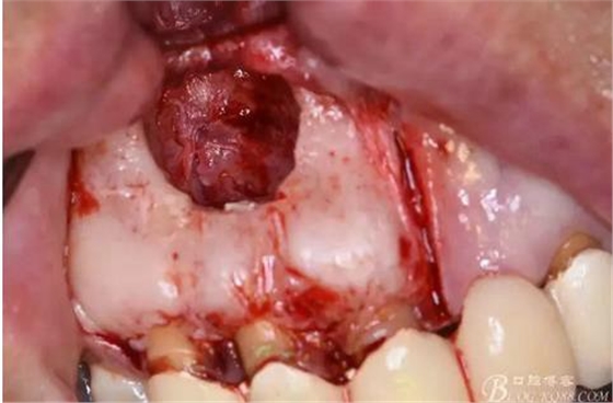 360截圖20170121152134117.jpg 360截圖20170121152134117.jpg