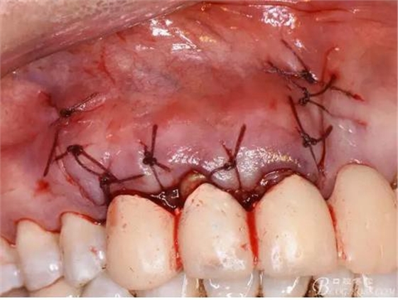 360截圖20170121152156453.jpg 360截圖20170121152156453.jpg