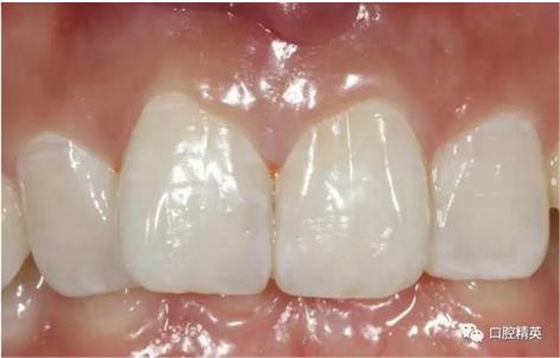 360截圖20170122111050280.jpg 360截圖20170122111050280.jpg