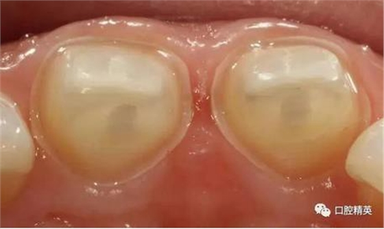 360截圖20170122111236960.jpg 360截圖20170122111236960.jpg