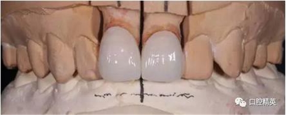 360截圖20170122111403305.jpg 360截圖20170122111403305.jpg