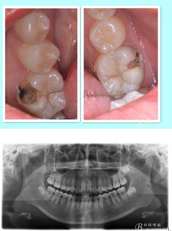 360截圖20170122165630879.jpg 360截圖20170122165630879.jpg