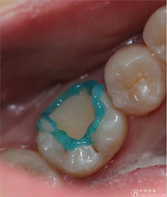 360截圖20170122170016450.jpg 360截圖20170122170016450.jpg