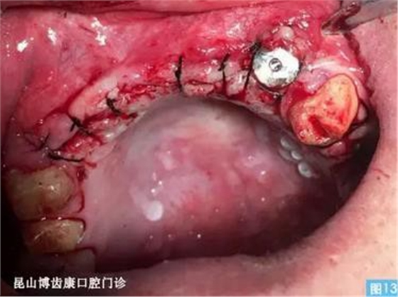 360截圖20170123095150422.jpg 360截圖20170123095150422.jpg