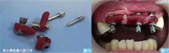 360截圖20170123095212806.jpg 360截圖20170123095212806.jpg