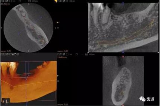 360截圖20170123164727107.jpg 360截圖20170123164727107.jpg