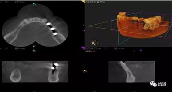 360截圖20170123164743874.jpg 360截圖20170123164743874.jpg