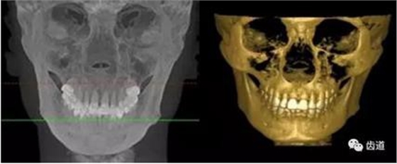 360截圖20170123164828582.jpg 360截圖20170123164828582.jpg